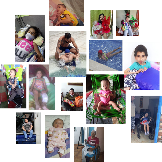 Qué es la Osteogenesis Imperfecta?
